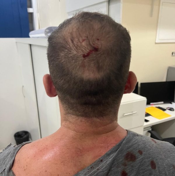 Síndico de condomínio-bairro em São Gonçalo é agredido em discussão por academia