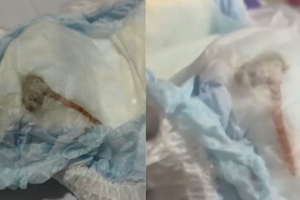 Mãe encontra rato morto dentro da fralda do bebê; veja o vídeo