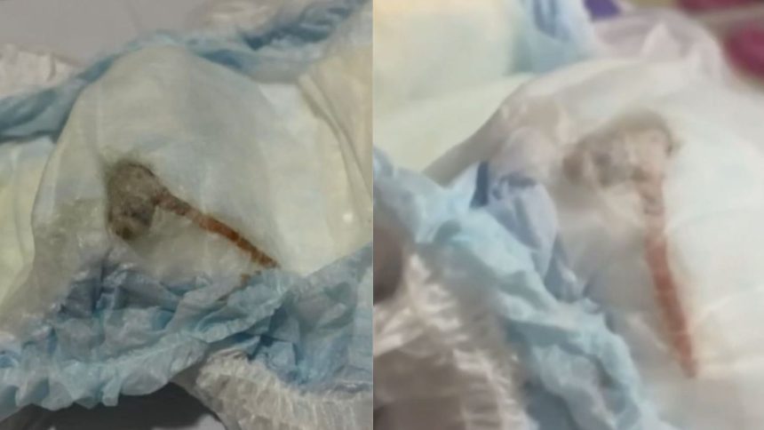 Mãe encontra rato morto dentro da fralda do bebê; veja o vídeo