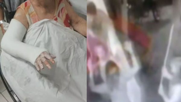 Idosa é agredida com cabo de vassoura durante briga em condomínio; veja o vídeo