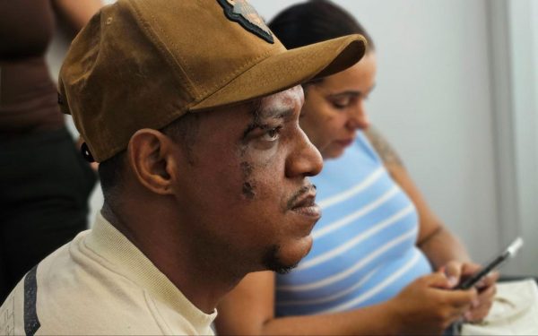 Vereadores levam ao MP denúncia de agressão a dançarino dos Hawaianos
