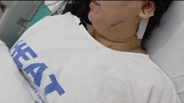 Violência contra a mulher em São Gonçalo: 16 agressões e 3 feminicídios são registrados em apenas um mês