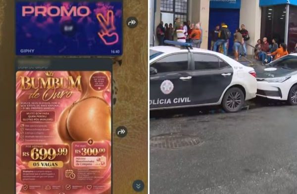 Clínica fechada pela Polícia Civil em Nova Iguaçu prometia 'bumbum de ouro' a clientes 51 Propaganda da clínica fechada por policiais em Nova Iguaçu prometia "Bumbum de Ouro"