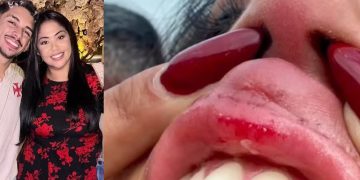 Ex-cunhado de cantora gospel é morto pelo filho dela em Campo Grande após agressão 10 Israel, apontado como o autor dos disparos, ao lado da mãe, Gisele, que mostrou marcas de agressão nas redes sociais
